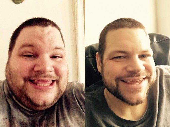 Ронни Брауэр, Ronnie Brower, парень похудел Тейлор Свифт, похудел на 200 кг