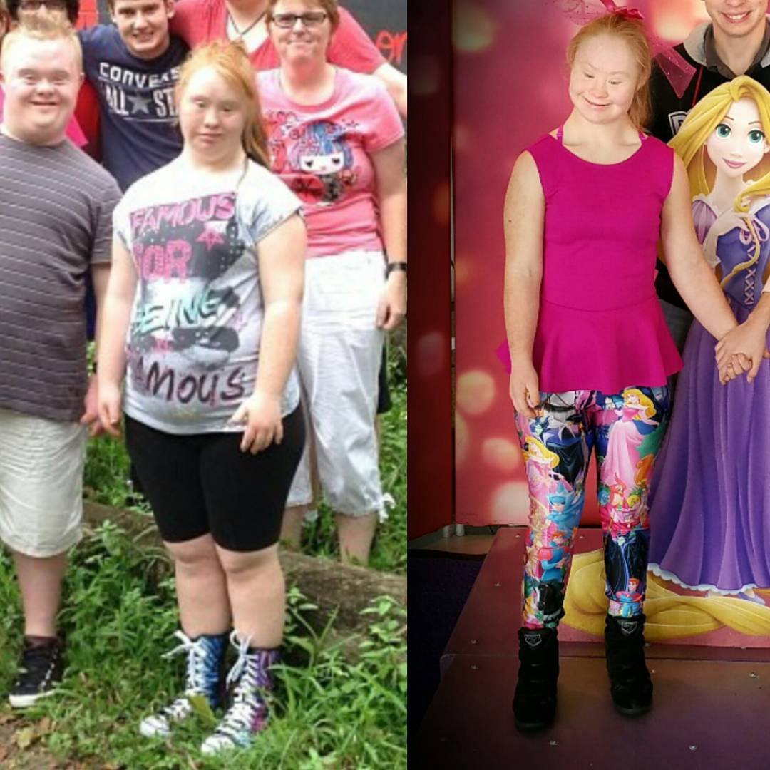 модель с синдромом Дауна, Маделин Стюарт, Madeline Stuart