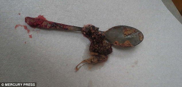 предметы извлеченные из желудков животных, рентгеновские снимки животных съевших предметы, необычные предметы съели животные