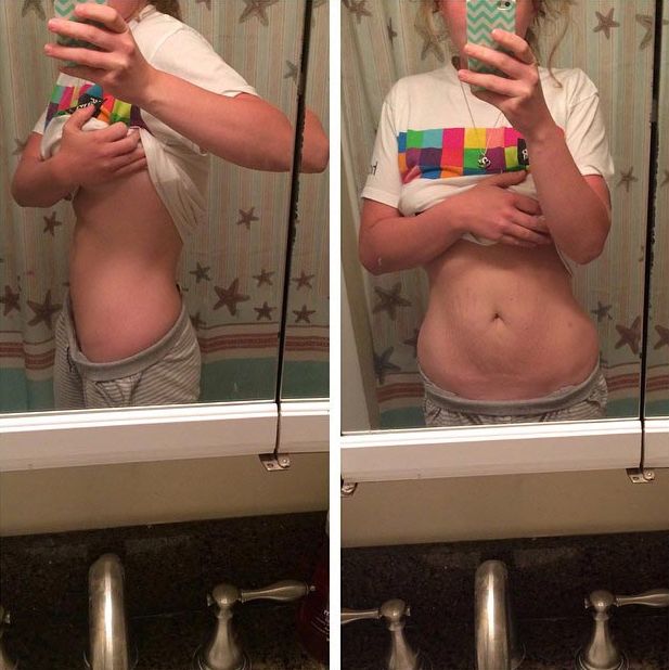 Покажи свой живот женщины с обычными фигурами, фотографии животов, #Mombod