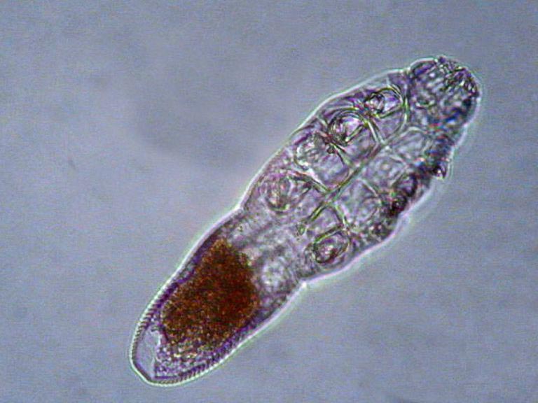 demodex, демодекс, железница, клещи на лице, клещи живут на нашем лице