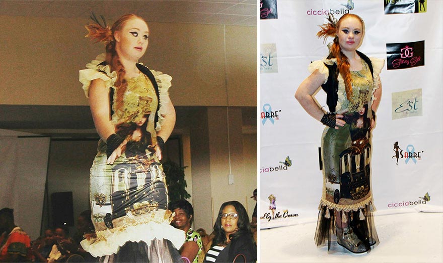 Маделин Стюарт, Madeline Stuart, модель с синдромом дауна