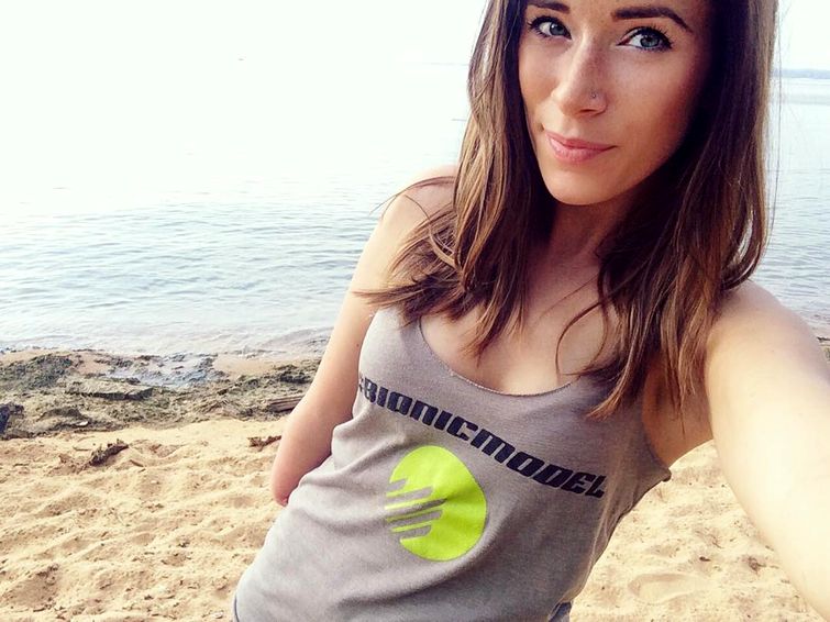 модель с бионической рукой, Ребека Марин, модель-инвалид на недели моды в Нью-Йорке