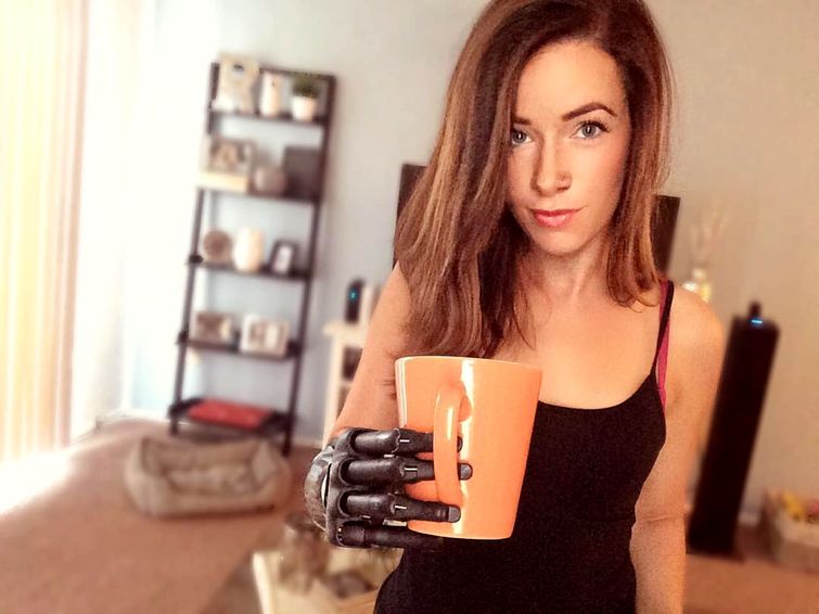 модель с бионической рукой, Ребека Марин, модель-инвалид на недели моды в Нью-Йорке