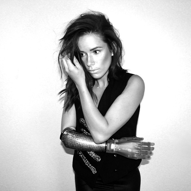 модель с бионической рукой, Ребека Марин, модель-инвалид на недели моды в Нью-Йорке