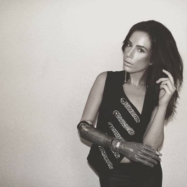 модель с бионической рукой, Ребека Марин, модель-инвалид на недели моды в Нью-Йорке