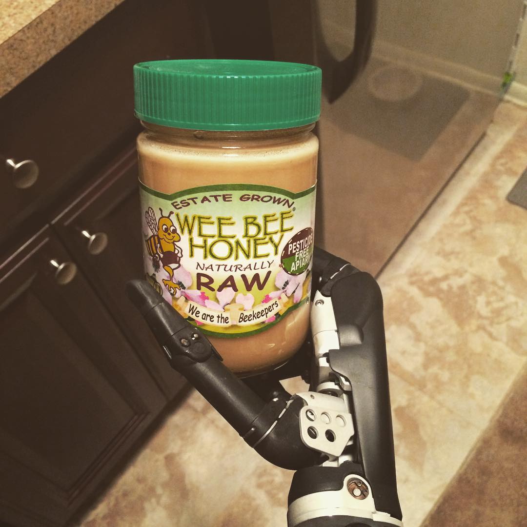 модель с бионической рукой, Ребека Марин, модель-инвалид на недели моды в Нью-Йорке