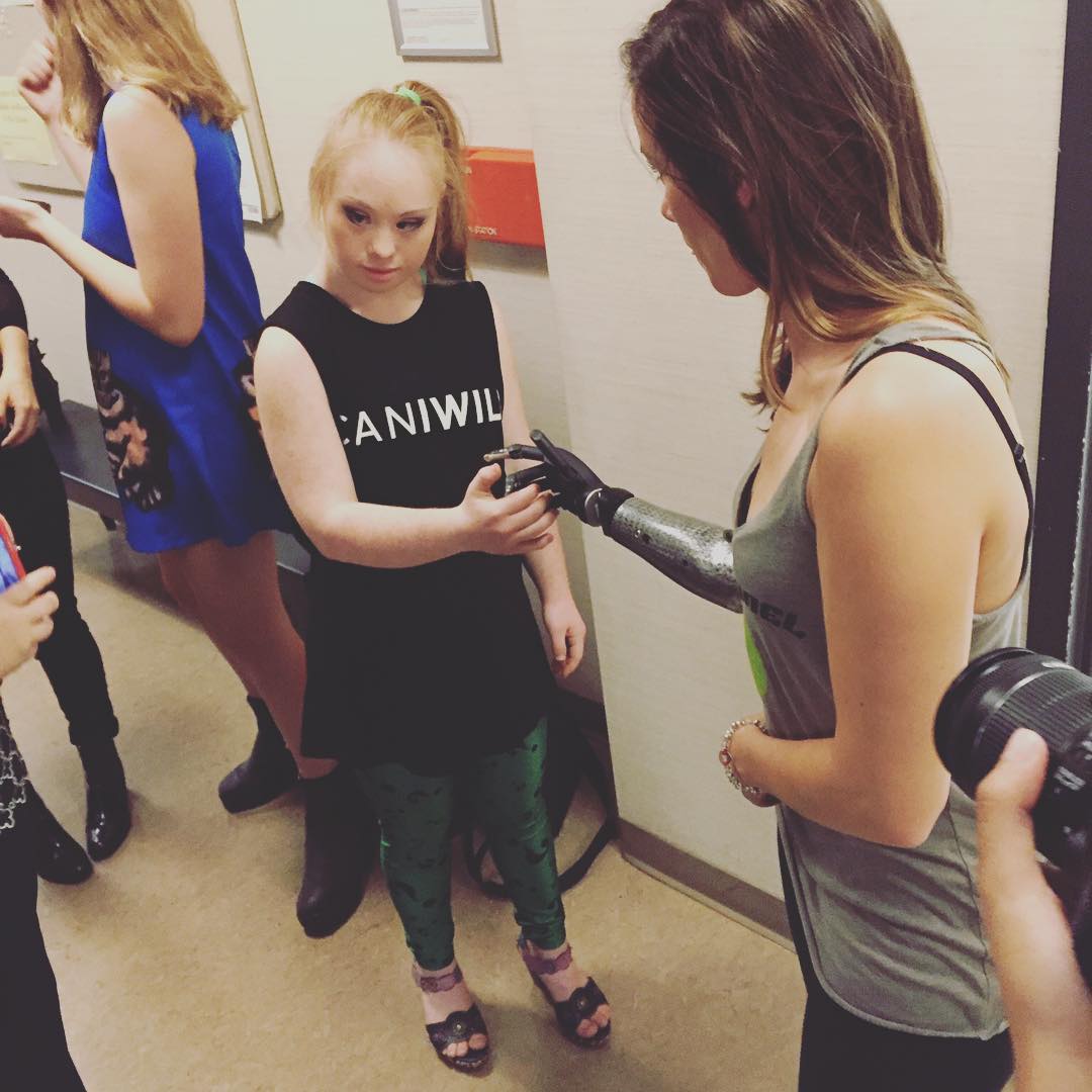 модель с бионической рукой, Ребека Марин, модель-инвалид на недели моды в Нью-Йорке