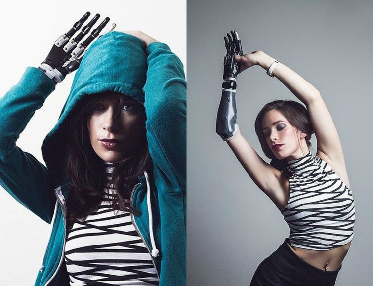 модель с бионической рукой, Ребека Марин, модель-инвалид на недели моды в Нью-Йорке