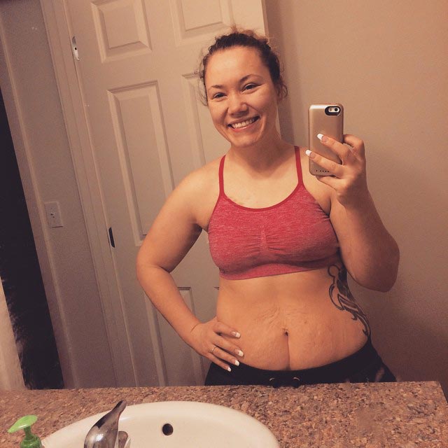 Полюби свои линии, полюби свои растяжки, женщины размещают фотографии своих растяжек, #LoveYourLines, Крисси Тейген