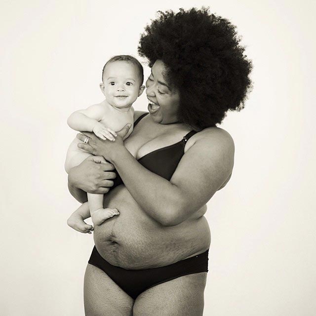 Полюби свои линии, полюби свои растяжки, женщины размещают фотографии своих растяжек, #LoveYourLines, Крисси Тейген