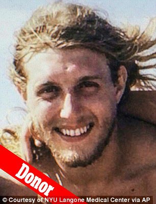 Новое лицо: обгоревший пожарный прошел через самую обширную операцию по пересадке лица в истории Пэт Хардисон, Pat Hardison, Дэвид Роудбах, David Rodebaugh, пересадка лица, самая крупная операция по пересадке лица, пересадка лица 2015