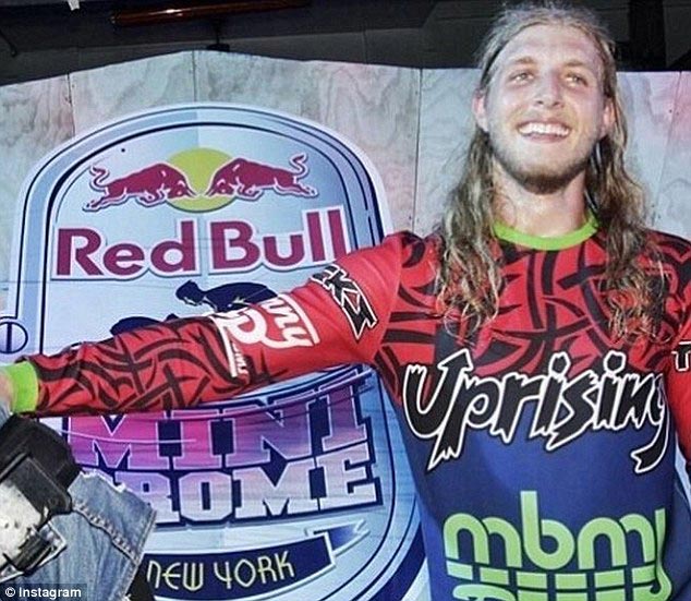 Новое лицо: обгоревший пожарный прошел через самую обширную операцию по пересадке лица в истории Пэт Хардисон, Pat Hardison, Дэвид Роудбах, David Rodebaugh, пересадка лица, самая крупная операция по пересадке лица, пересадка лица 2015