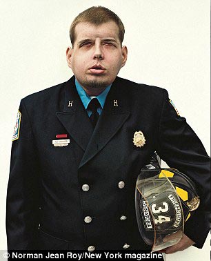 Новое лицо: обгоревший пожарный прошел через самую обширную операцию по пересадке лица в истории Пэт Хардисон, Pat Hardison, Дэвид Роудбах, David Rodebaugh, пересадка лица, самая крупная операция по пересадке лица, пересадка лица 2015