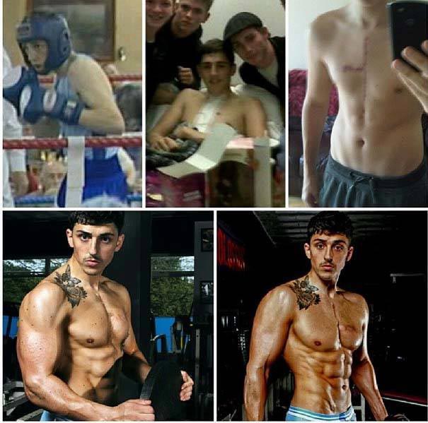 после удара ножом и трёх смертей, парень стал бодибилдером, накача мышцы после больницы