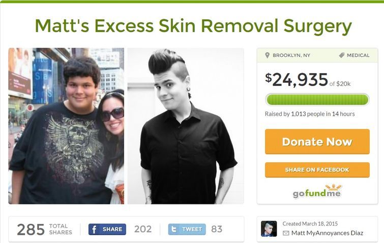 Парень похудел на 122 килограмма, и смело показал свою обвисшую кожу всему миру Мэтт Диас, Matt Diaz, парень похудел на 122 кг, обвисшая кожа