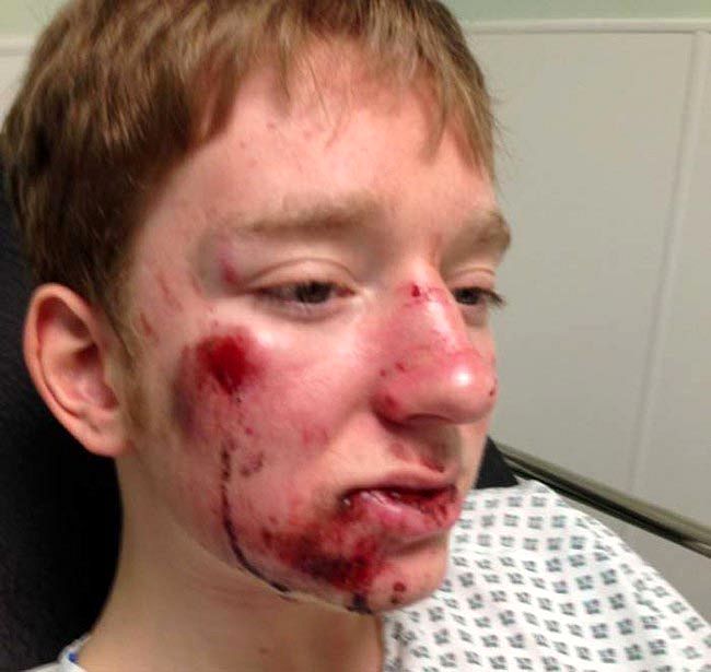 женщина сбила велосипедиста, женщина сбила подростка на велосипеде, женщина отказалась помочь велосипедисту