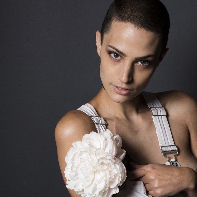 Девушка подписала крупный модельный контракт, находясь на четвертой стадии рака Дайна Кристисон, Dayna Christison, подписала модельный контракт на четвертой стадии рака, модель на четвертой стадии рака, модель 4 стадия рака