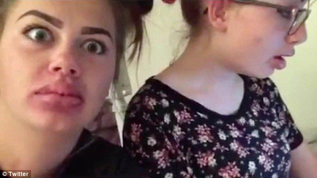 губы как у Кайли Дженнер,#kyliejennerchallenge, экстремальное увеличение губ, засовывают губы в маленькие баночки, увеличение губ отек