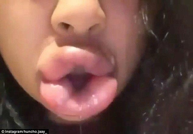 губы как у Кайли Дженнер,#kyliejennerchallenge, экстремальное увеличение губ, засовывают губы в маленькие баночки, увеличение губ отек