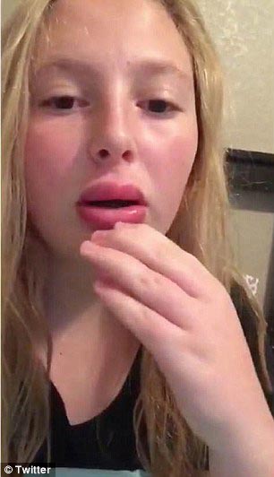 губы как у Кайли Дженнер,#kyliejennerchallenge, экстремальное увеличение губ, засовывают губы в маленькие баночки, увеличение губ отек