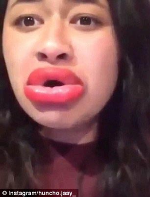 губы как у Кайли Дженнер,#kyliejennerchallenge, экстремальное увеличение губ, засовывают губы в маленькие баночки, увеличение губ отек