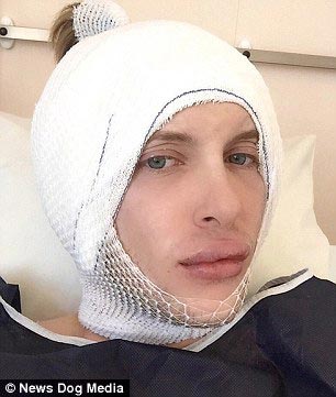 Анастасия Рискосс, Anastasia Reskoss, Квентаин Дехар,Quentin Dehar, пара пластические операции стать похожими на Барби и Кена