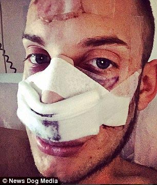 Анастасия Рискосс, Anastasia Reskoss, Квентаин Дехар,Quentin Dehar, пара пластические операции стать похожими на Барби и Кена