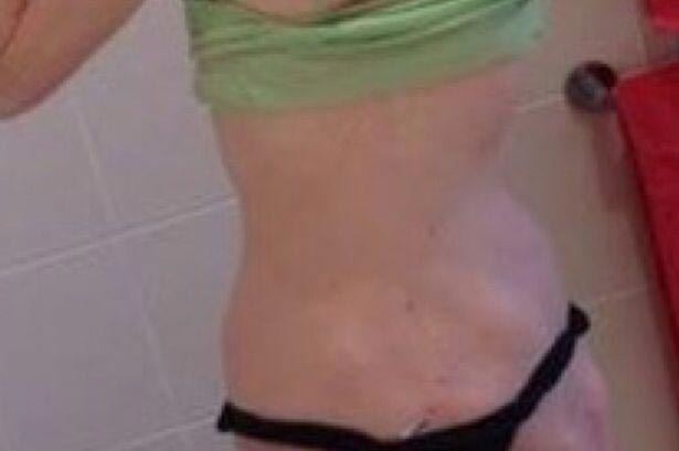 Из анорексички с весом меньше 40 кг в спортсменку, выступающую в категории бикини из анорексички в модель бикини, из анорексички в спортсменку бикини, весила 37 кг