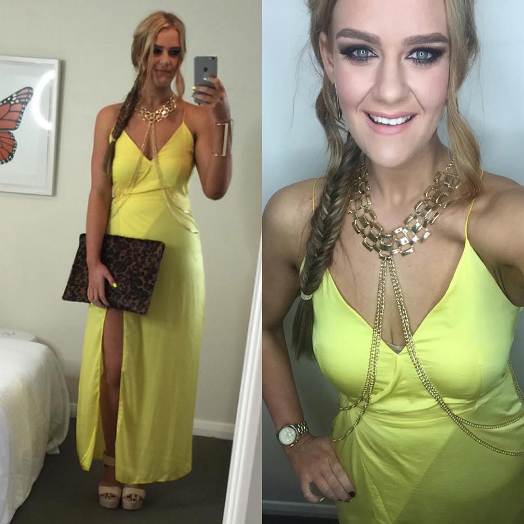 Неожиданно: храбрый ответ девушки на обвинение в подделке фотографий до и после похудения Симон Андерсон, Simone Anderson, фото обвисшей кожи, доказательство похудения фото обвисшей кожи