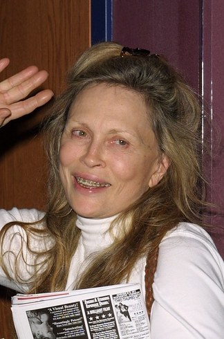 14 знаменитостей, доказывающих, что брекеты могут изменить всю вашу жизнь звёзды в брекетах, звёзды с брекетами, улыбки звёзд, зубы знаменитостей