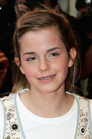 14 знаменитостей, доказывающих, что брекеты могут изменить всю вашу жизнь звёзды в брекетах, звёзды с брекетами, улыбки звёзд, зубы знаменитостей