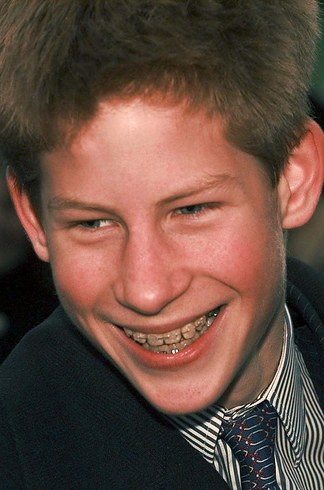 14 знаменитостей, доказывающих, что брекеты могут изменить всю вашу жизнь звёзды в брекетах, звёзды с брекетами, улыбки звёзд, зубы знаменитостей