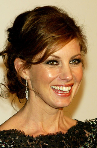 14 знаменитостей, доказывающих, что брекеты могут изменить всю вашу жизнь звёзды в брекетах, звёзды с брекетами, улыбки звёзд, зубы знаменитостей