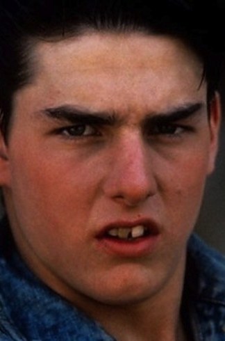 14 знаменитостей, доказывающих, что брекеты могут изменить всю вашу жизнь звёзды в брекетах, звёзды с брекетами, улыбки звёзд, зубы знаменитостей