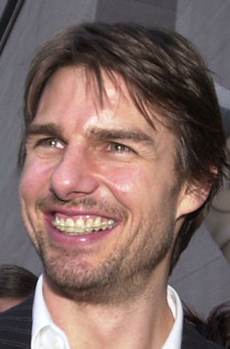 14 знаменитостей, доказывающих, что брекеты могут изменить всю вашу жизнь звёзды в брекетах, звёзды с брекетами, улыбки звёзд, зубы знаменитостей