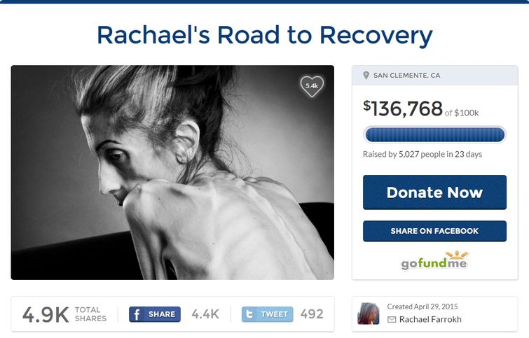  Рэйчел Фаррох, Rachael Farrokh, женщина весит 18 кг, женщина умирает от анорексии, слишком худая, чтобы жить,