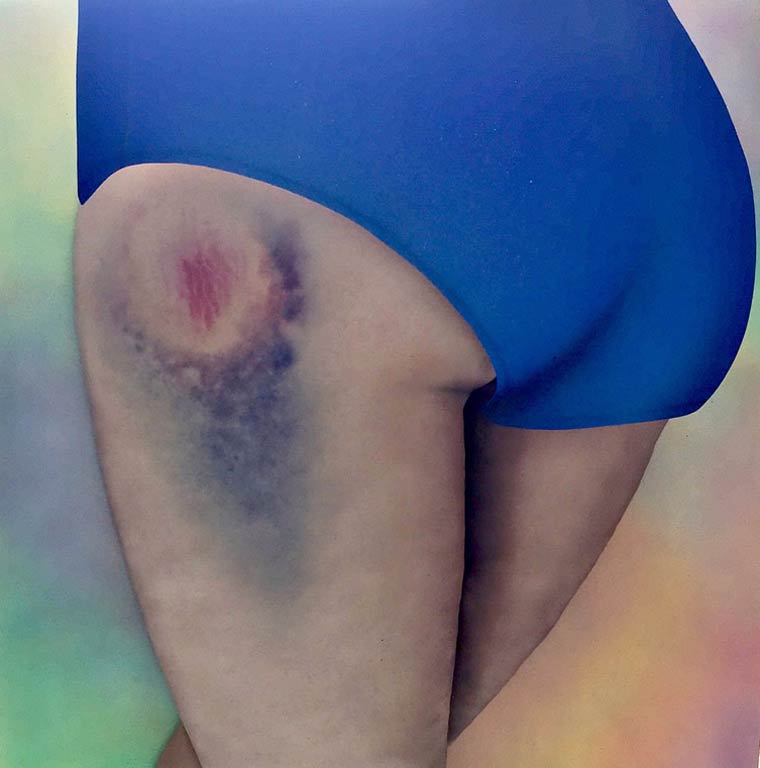 Roller Derby Kisses, Поцелуи роллер-дерби, Риикка Хивонен, Riikka Hyvönen, синяки произведения искусства