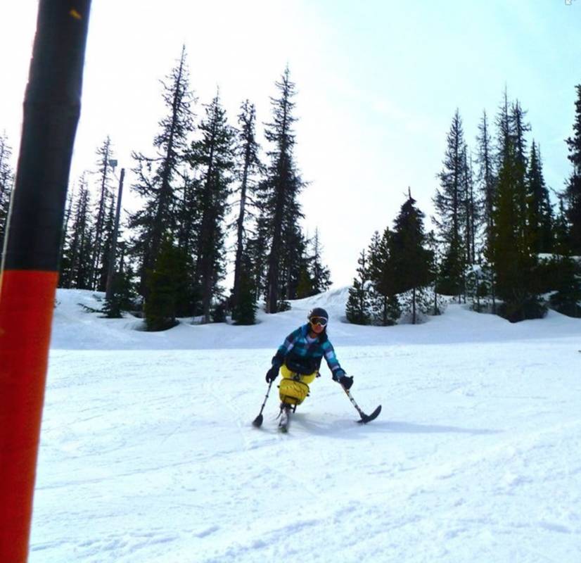 Канья Сессер, девушка без ног ставшая моделью 