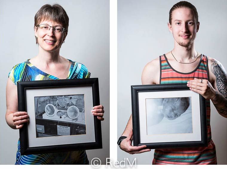 преждевременные, недоношенные дети фото сразу после рождения, недоношенные дети держат свои фото после рождения