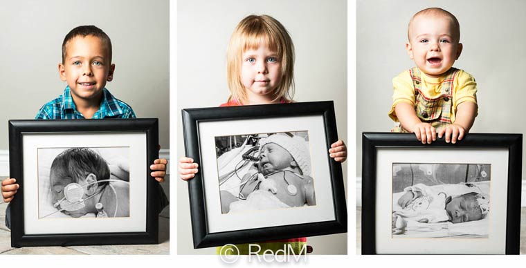 преждевременные, недоношенные дети фото сразу после рождения, недоношенные дети держат свои фото после рождения