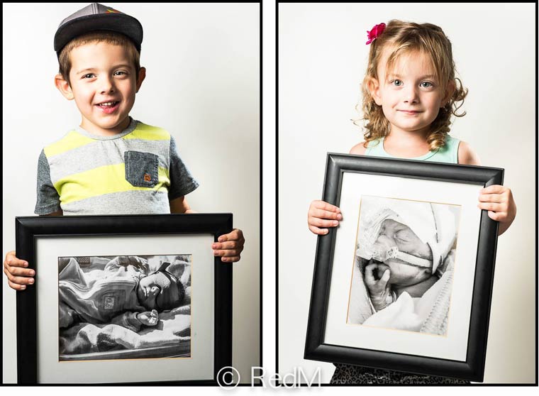 преждевременные, недоношенные дети фото сразу после рождения, недоношенные дети держат свои фото после рождения