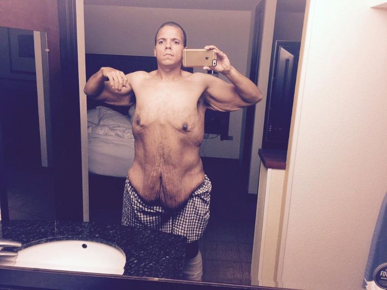 парень похудел на 200 кг, парень похудел до и после, похудел после троллинга 