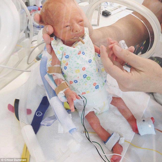 родила тройню на 7 месяце беременности, родила тройню спасти жизнь дочери