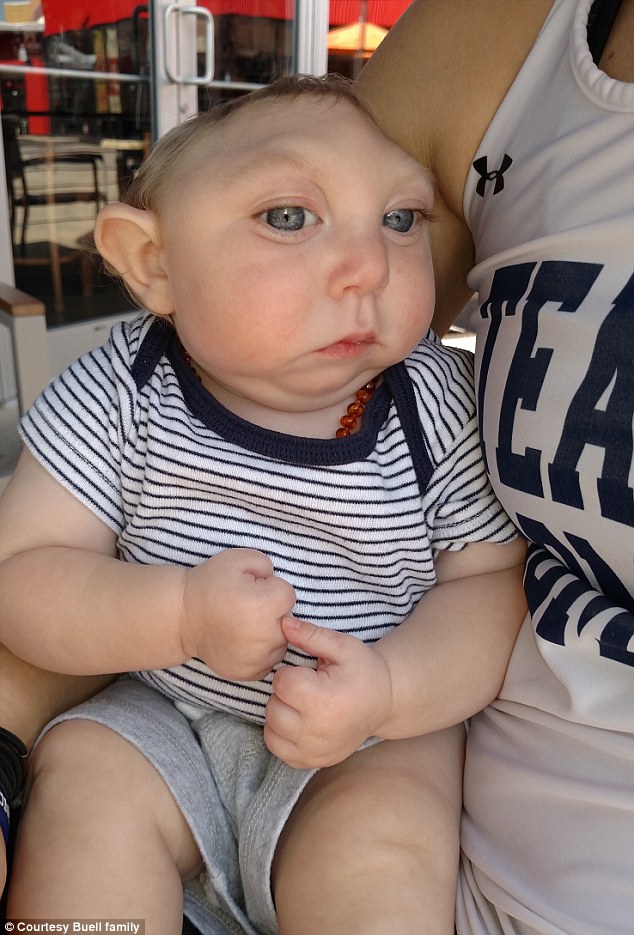 Ребенок, родившийся без части мозга и черепа не только выжил, но и отпраздновал свой первый день рождения ребёнок без части мозга и черепа, сильный Джексон