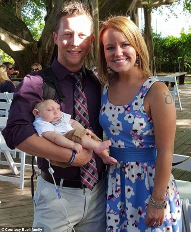 Ребенок, родившийся без части мозга и черепа не только выжил, но и отпраздновал свой первый день рождения ребёнок без части мозга и черепа, сильный Джексон