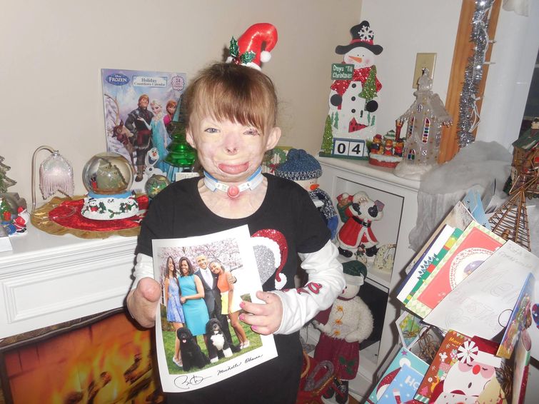 Сафайр Терри, Safyre Terry, обгоревшая девочка рождественские открытки, обгоревшая девочка получила рождественские открытки