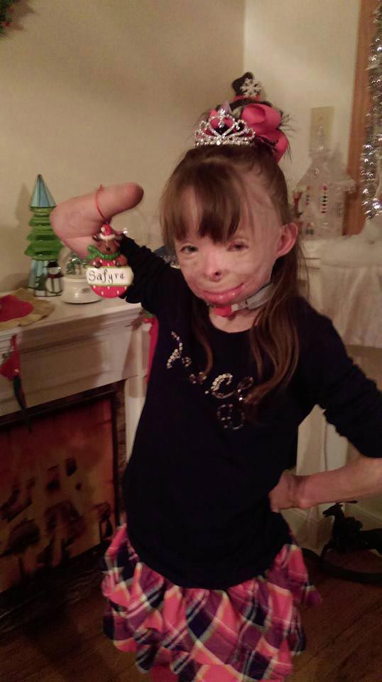 Сафайр Терри, Safyre Terry, обгоревшая девочка рождественские открытки, обгоревшая девочка получила рождественские открытки