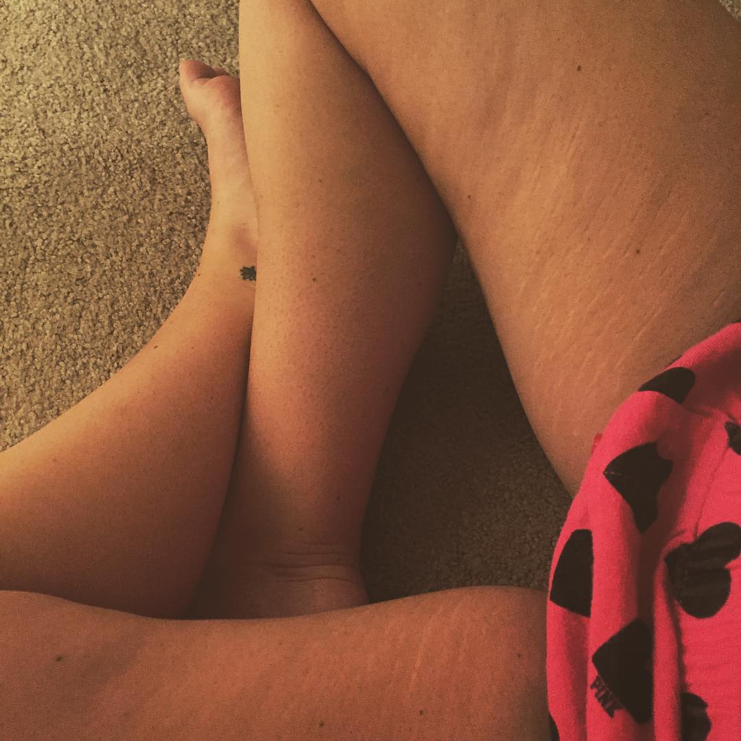 девушки показывают свои растяжки и целлюлит, #ThighReading