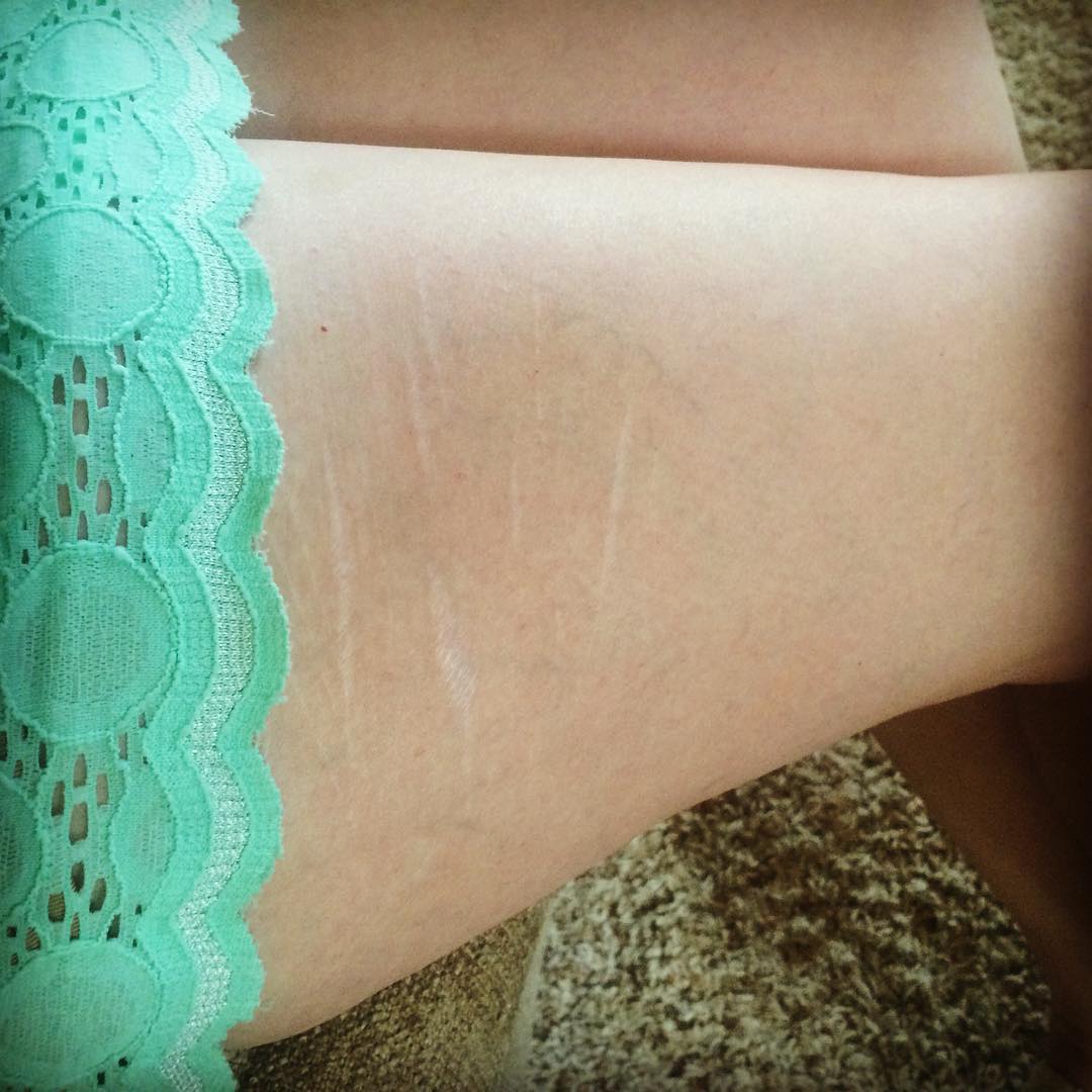 девушки показывают свои растяжки и целлюлит, #ThighReading